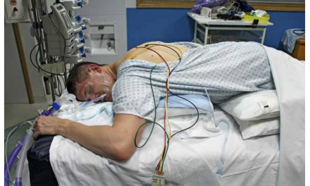 Placing COVID patients face down can help lung function but it’s labour intensive